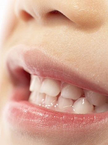 bruxismo dental bruxismodental1