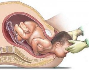 la posición del bebé 
