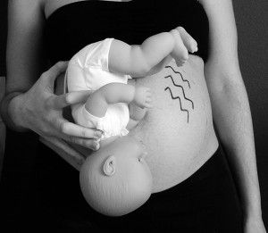 belly mapping en las embarazadas